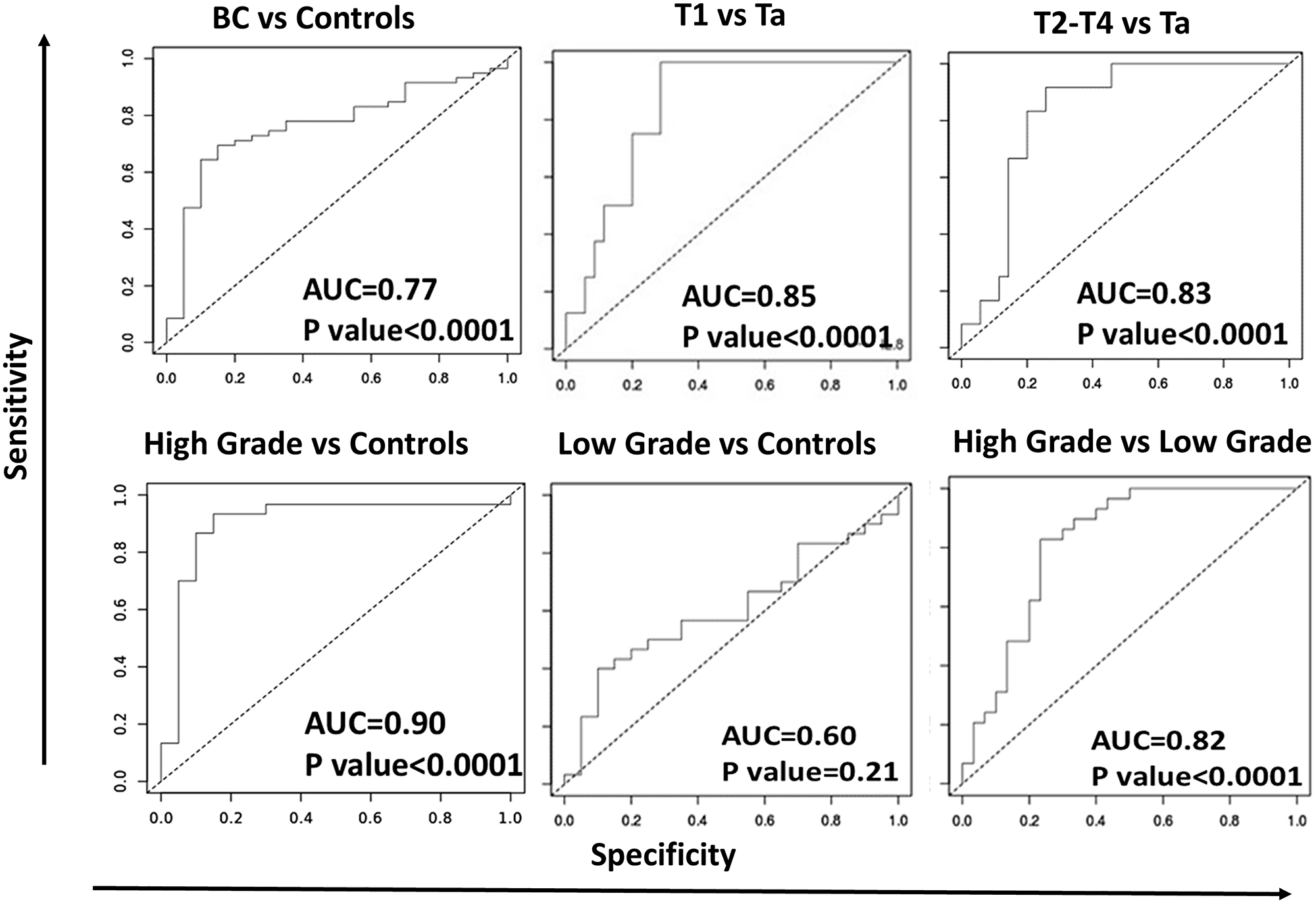 Figure 4: ROC-AUC curves for urine IL-8 in distinguishing different stages of bladder cancer.